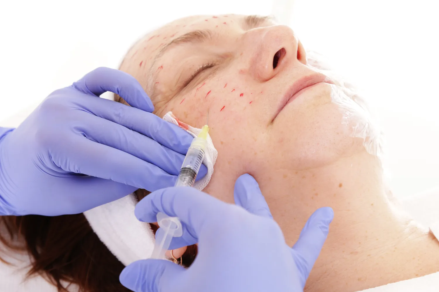 Medycyna estetyczna co to jest?