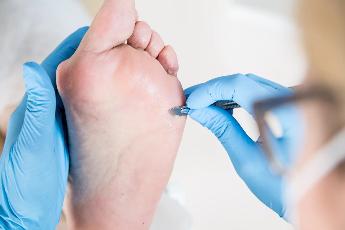 Pedicure leczniczy - co na ten temat wiedzieć trzeba?