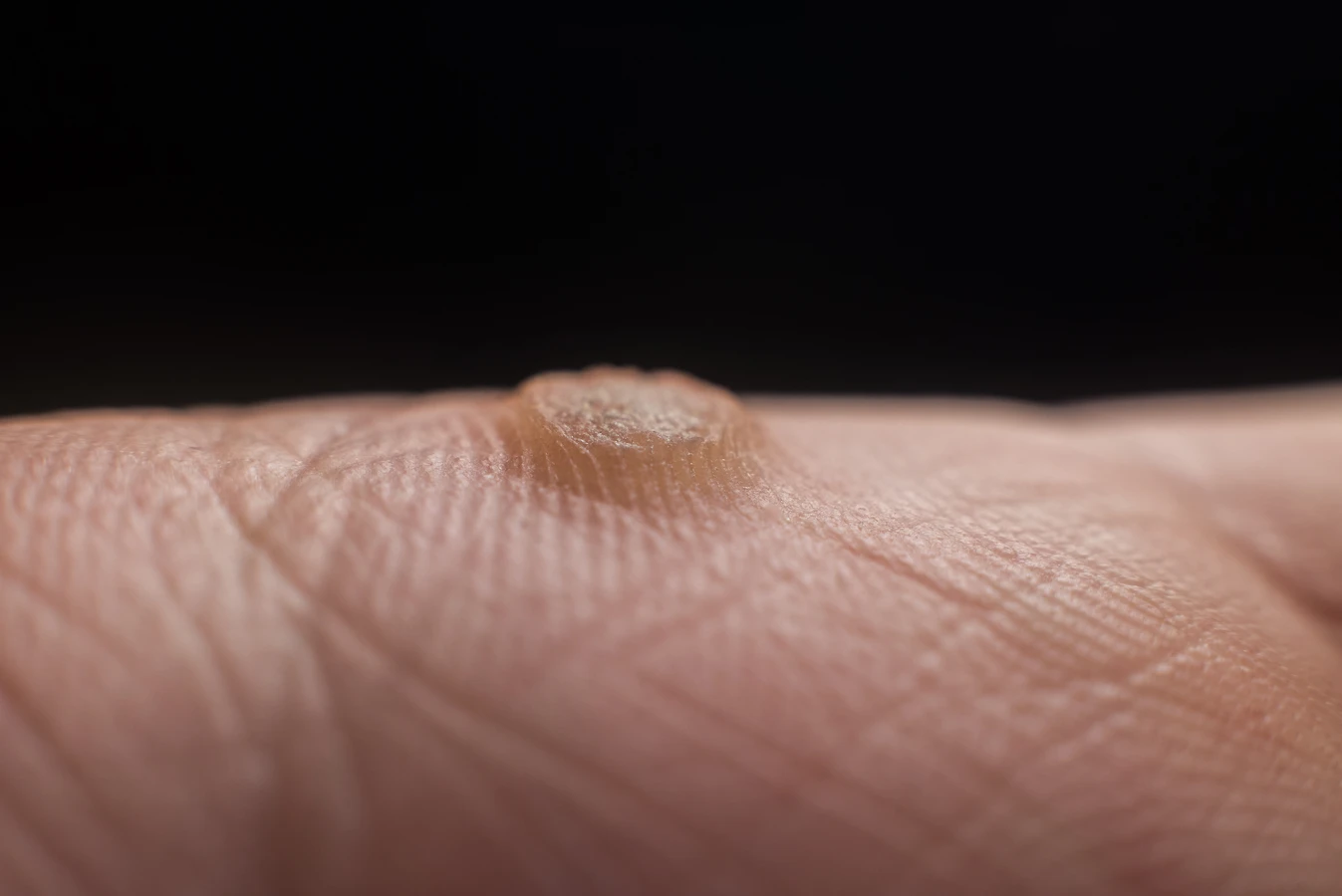 Leczymy stopy, czyli wizyta u podologa