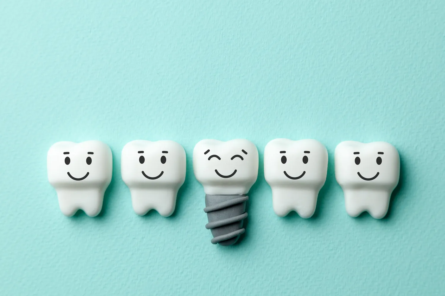 Implanty w jeden dzień Szczecin