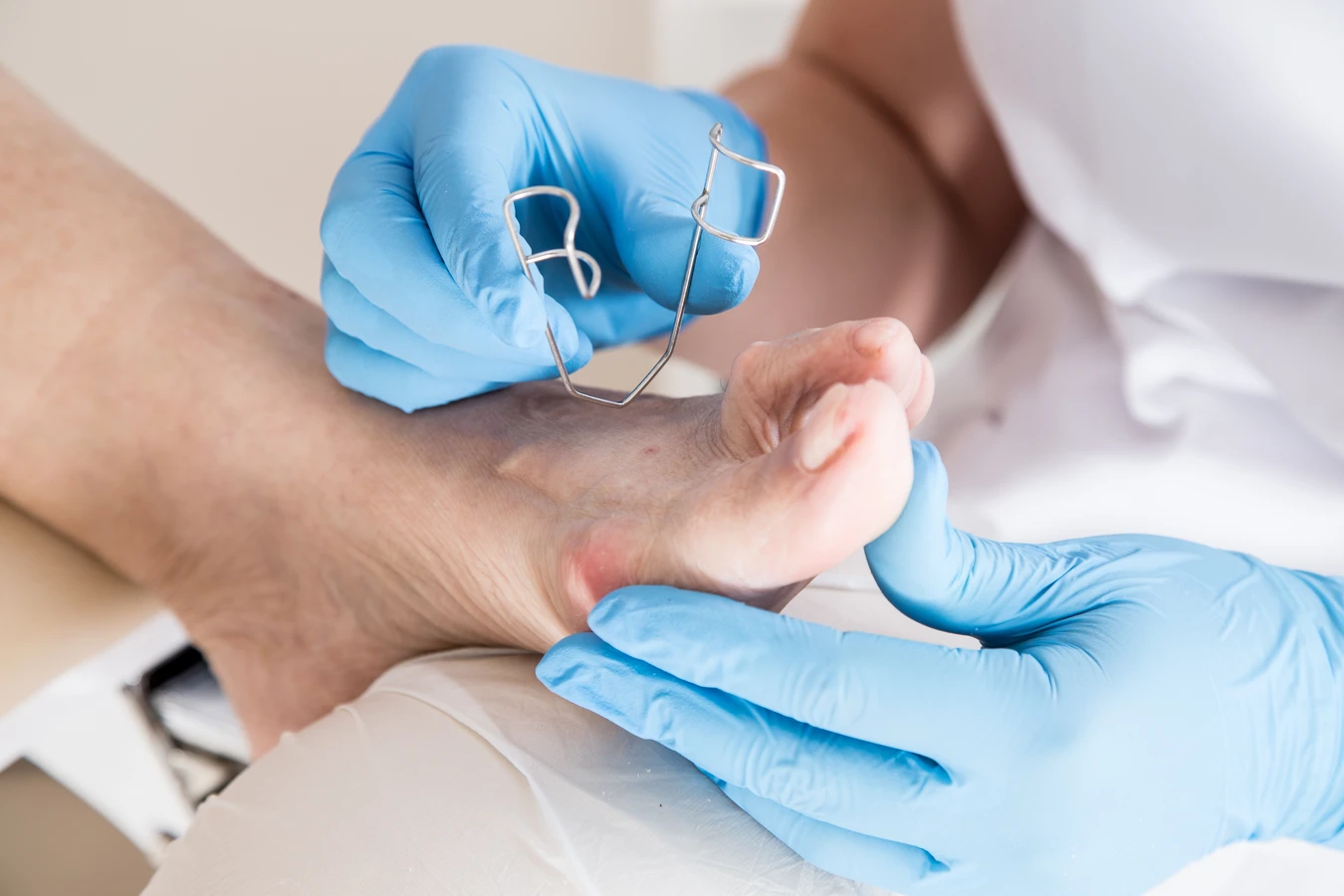 Kompendium informacji na temat pedicure leczniczego